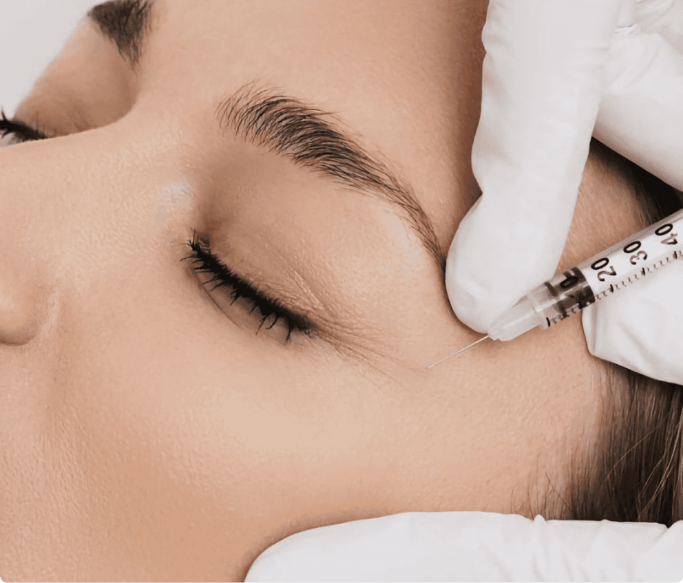 BOTULINOTERAPIA (BOTOX) 7