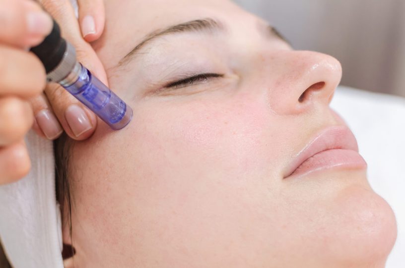MEZOTERAPIA 1